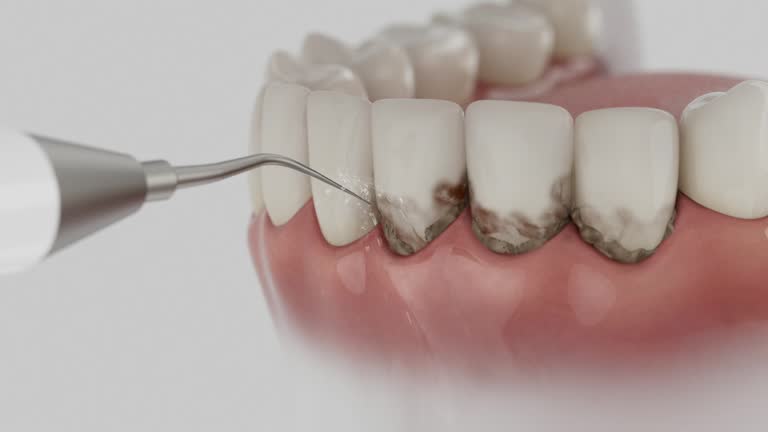 Reliable Dental contractor in Hanley Hills, MO by Dentist Open Now